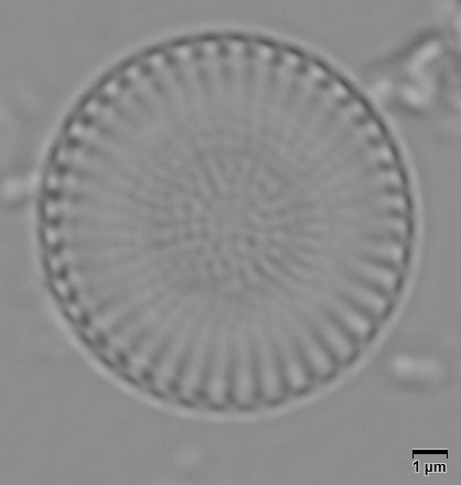 Cyclostephanos dubius, (Fricke) Round in Theriot et al., 1987 | Sandre 