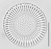 Cyclostephanos dubius, (Fricke) Round in Theriot et al., 1987 | Sandre 