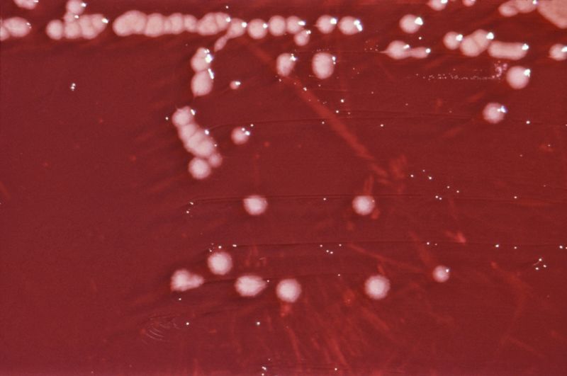 Pseudomonas - Paramètre microbiologique