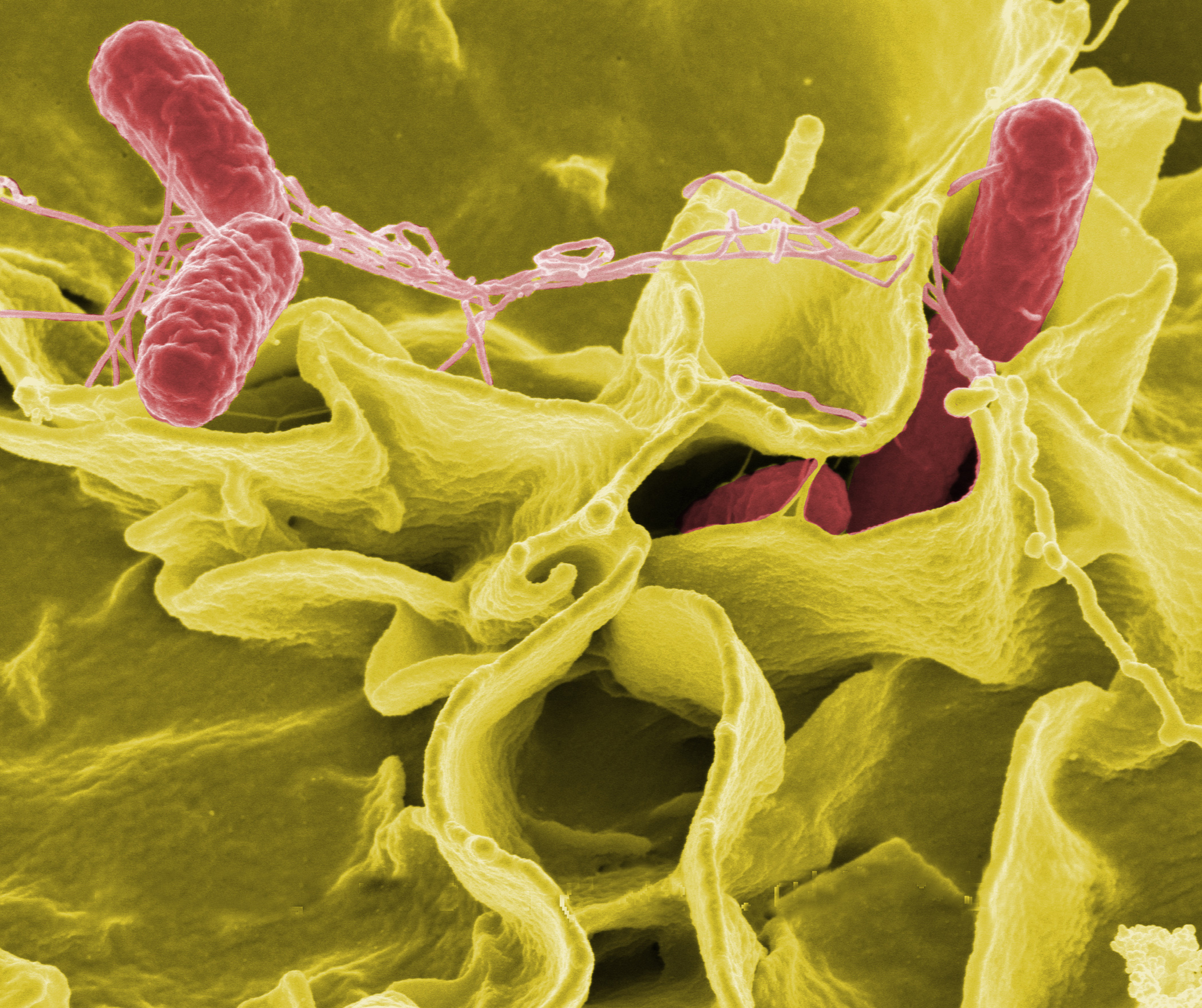 Salmonella - Paramètre microbiologique